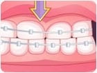 เกมส์ดัดฟันเหมือนจริง Bad Teeth Makeover