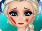 เกมส์เอลซ่าทำศัลยกรรม Elsa Real Surgery