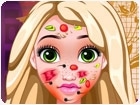 เกมส์รักษาหน้าราพันเซล Rapunzel Facial Skin Doctor