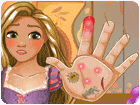 เกมส์รักษามือให้เจ้าหญิงผมยาวราพันเซล Rapunzel Hand Doctor Game