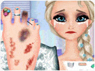 เกมส์รักษาเท้าให้เจ้าหญิงเอลซ่า Elsa Foot Injured Game