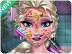 เกมส์รักษาใบหน้าเจ้าหญิงเอลซ่า Elsa Skin Doctor