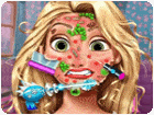 เกมส์คุณหมอรักษาใบหน้าราพันเซล Goldie Princess Skin Doctor Game
