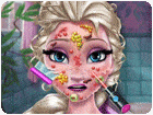 เกมส์รักษาใบหน้าให้เจ้าหญิงหิมะ Ice Queen Skin Doctor