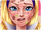 เกมส์รักษาใบหน้าซุปเปอร์บาร์บี้ Barbie Hero Face Problem