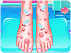 เกมส์ทำทรีทเม้นท์เท้าให้เอมม่า Emma Foot Treatment Game