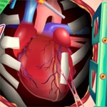 เกมส์ผ่าตัดเปลี่ยนหัวใจ Heart Transplant Surgery